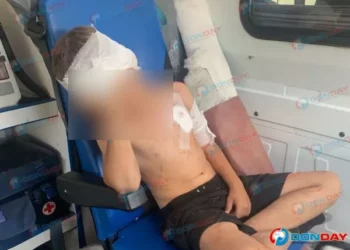 ПОКУСАЛ ВОЛК