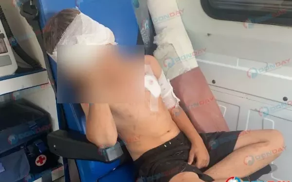 ПОКУСАЛ ВОЛК